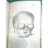 Morgan, John Lectures on Diseases of the Eye 1839 - TC Books