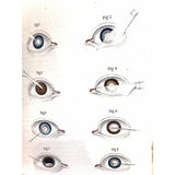 Morgan, John Lectures on Diseases of the Eye 1839 - TC Books