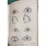 Morgan, John Lectures on Diseases of the Eye 1839 - TC Books