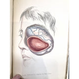 Morgan, John Lectures on Diseases of the Eye 1839 - TC Books